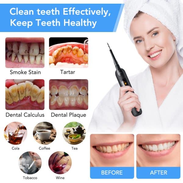 Nettoyeur de dents intelligent haute fréquence à 5 vitesses avec affichage LED. Détartreur dentaire – Image 3