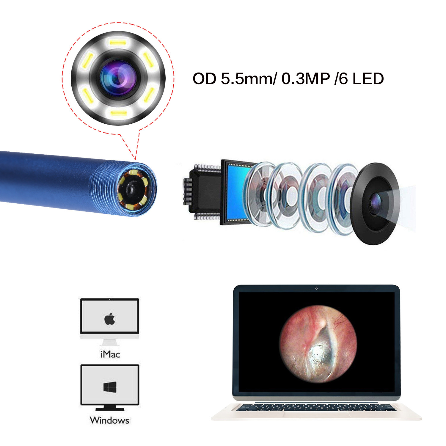 Nettoyeur visuel d'oreilles, nez et bouche. Version informatique de l'endoscope – Image 3