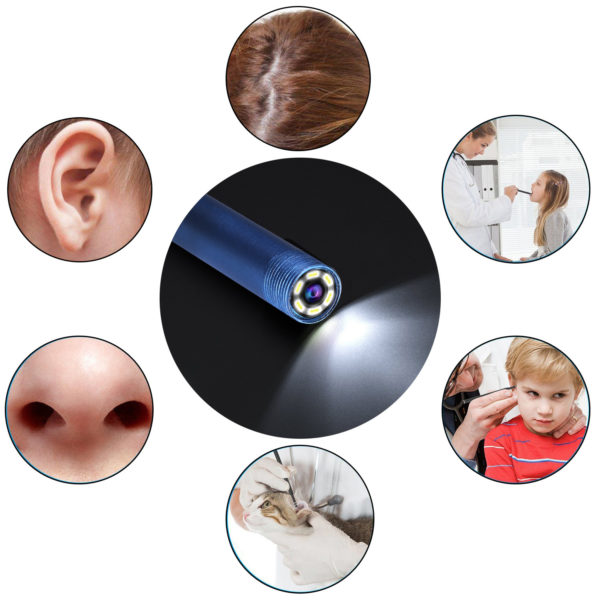 Nettoyeur visuel d'oreilles, nez et bouche. Version informatique de l'endoscope – Image 5