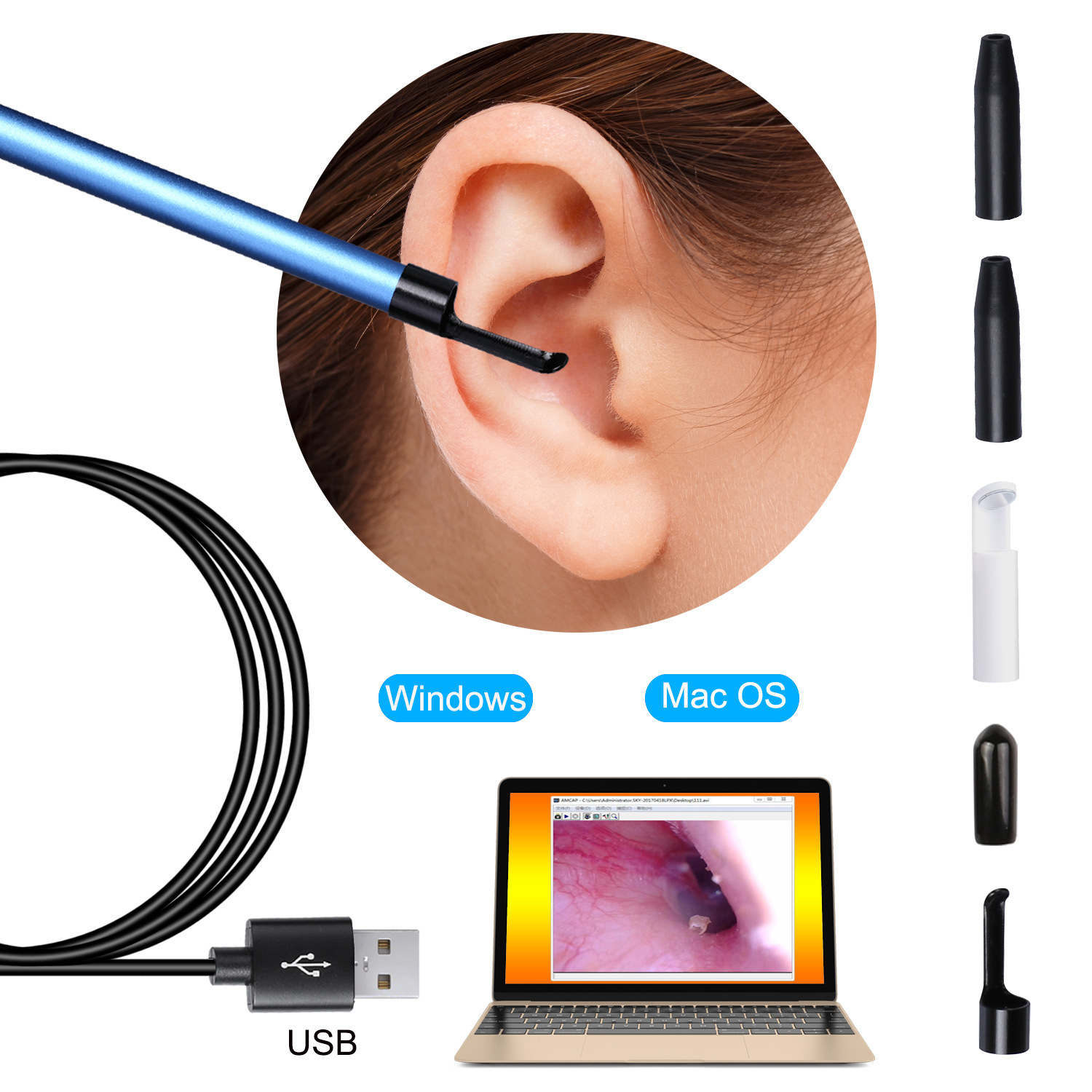 Nettoyeur visuel d'oreilles, nez et bouche. Version informatique de l'endoscope – Image 2