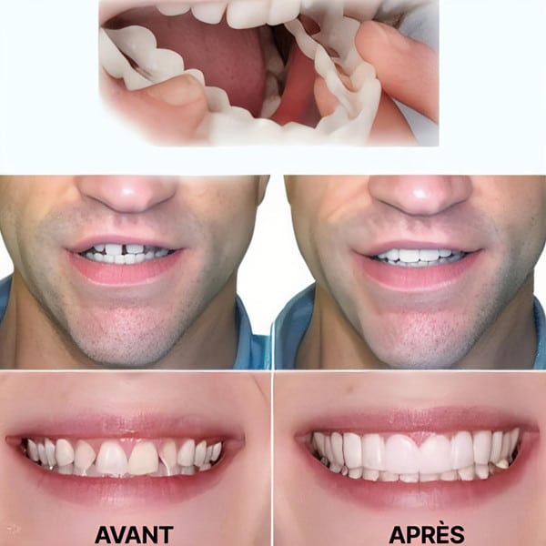 Une paire de prothèses dentaires supérieures et inférieures ajustable pour hommes et femmes – Image 4