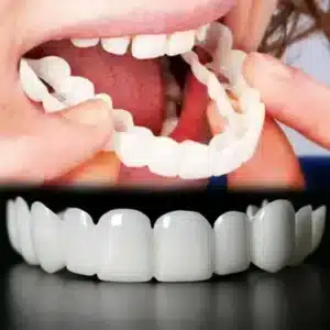 Dentier. Une paire de prothèses dentaires supérieures et inférieures ajustable pour hommes et femmes