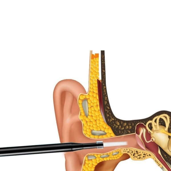 Nettoyeur d’oreilles, du nez et de la bouche avec caméra. Version informatique de l’endoscope – Image 2